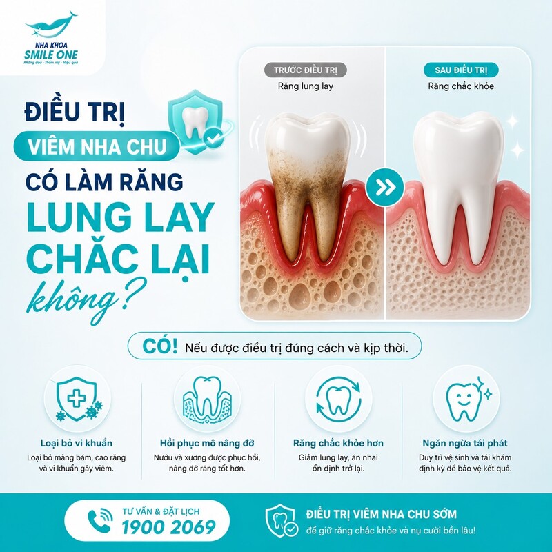 Nẹp có thể giúp răng lung lay ổn định hơn và phân bố lực tốt hơn trong trường hợp phù hợp