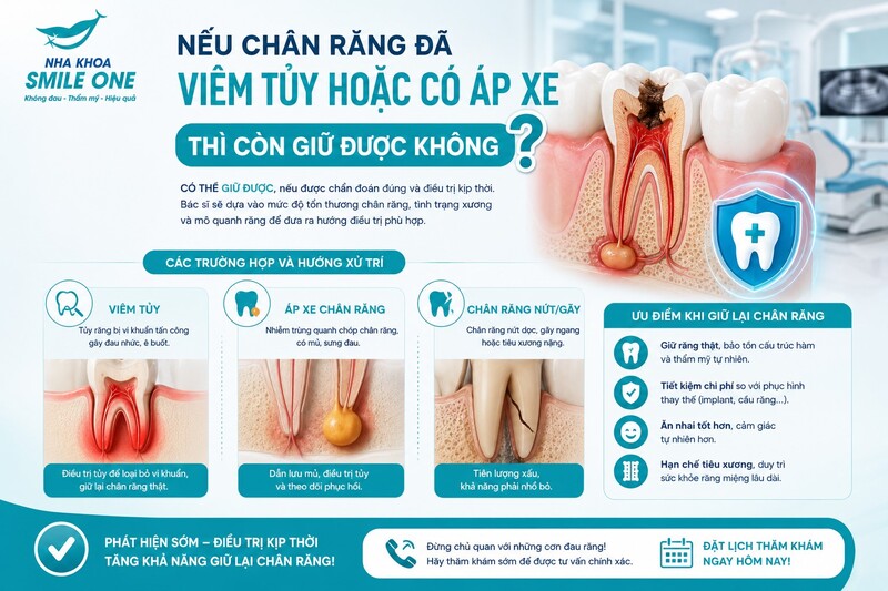 Răng chỉ còn chân thường nên nhổ khi chân đã nứt/gãy bất lợi, sâu phá hủy quá sâu