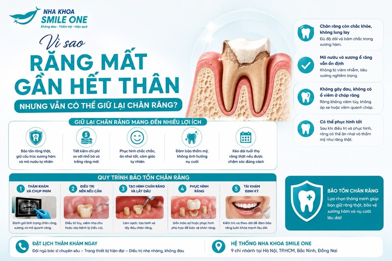 Chân răng còn khả năng phục hồi khi không bị nứt/gãy bất lợi,