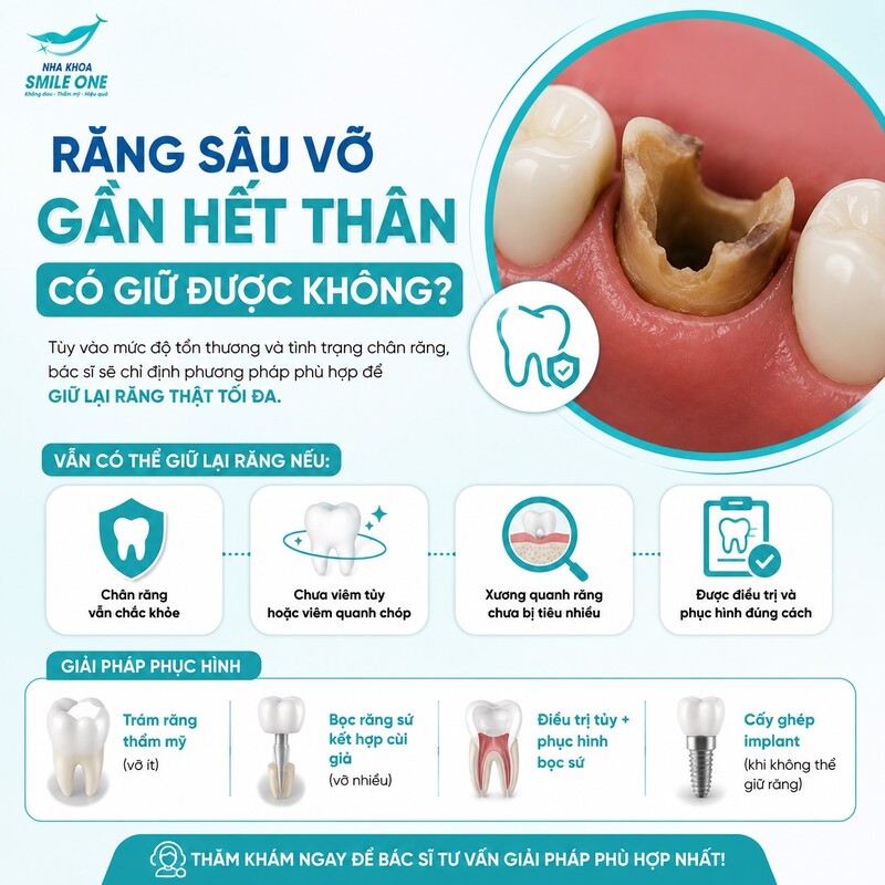 Không nhất thiết. Lỗ sâu nhìn rất to chỉ cho thấy răng đã mất nhiều mô hơn
