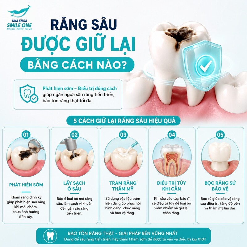 Răng sâu còn giữ được khi phần bệnh có thể xử lý và sau đó bác sĩ