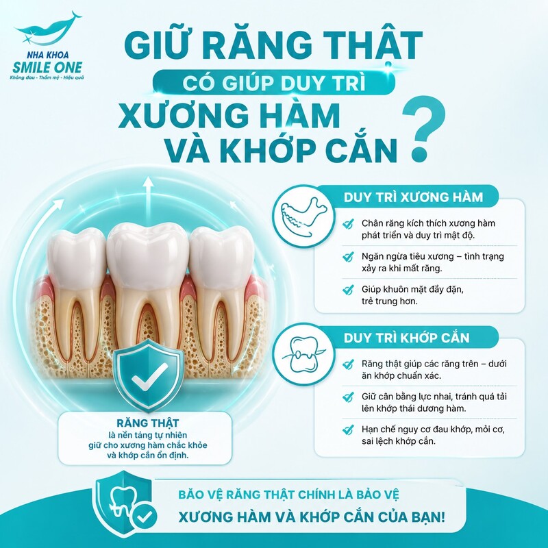 Giữ được một chiếc răng có tiên lượng tốt giúp duy trì cấu trúc tự nhiên tại vị trí đó.