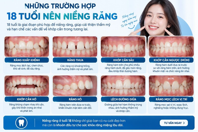 Không có phương pháp nào tốt nhất cho tất cả người 18 tuổi.