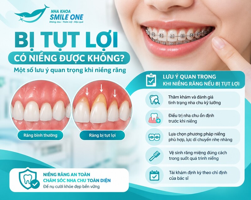 Không nên chỉ nhìn phần chân răng lộ ra ngoài để kết luận có thể niềng hay không.
