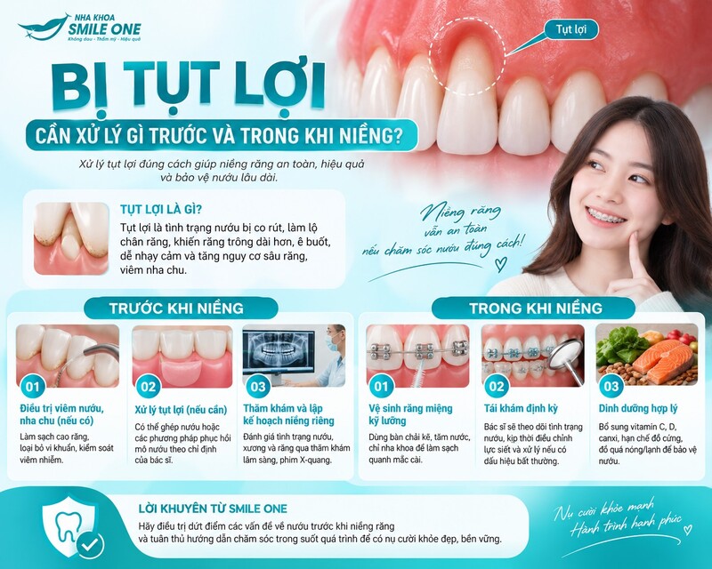 Niềng răng không làm phần lợi đã tụt tự mọc trở lại. Mục tiêu chỉnh nha là sắp xếp răng về vị trí phù hợp nhưng vẫn bảo tồn phần nướu và xương đang nâng đỡ chân răng.