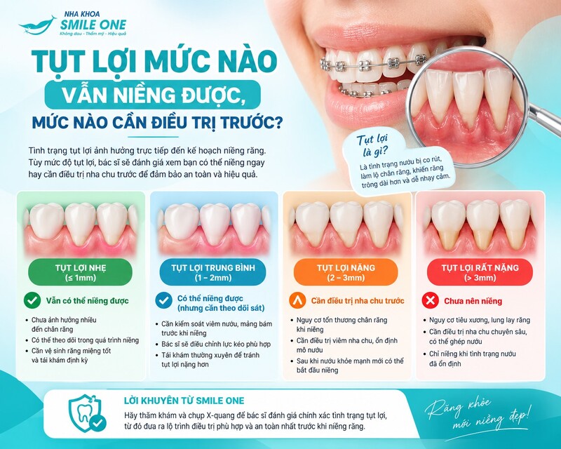 Không nhất thiết. Tụt lợi nhẹ vẫn có thể niềng mà không làm tình trạng