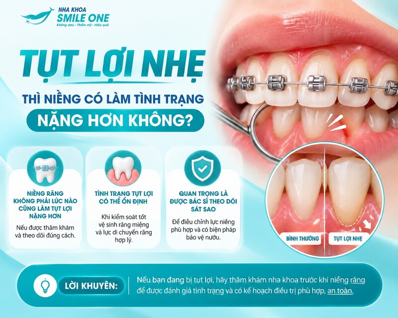 Có. Bị tụt lợi vẫn có thể niềng răng nếu tình trạng nha chu đã ổn định,