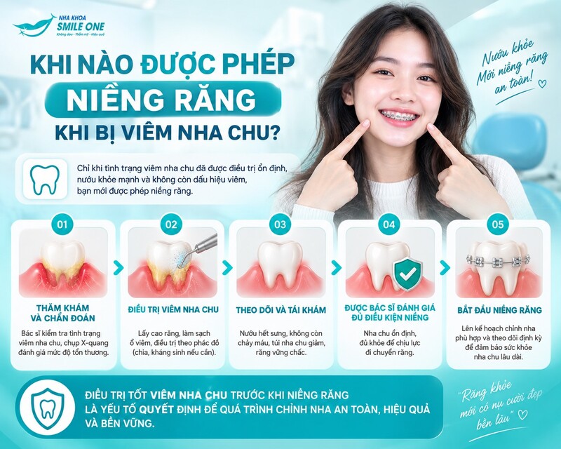 Bị viêm nha chu vẫn có thể niềng răng,