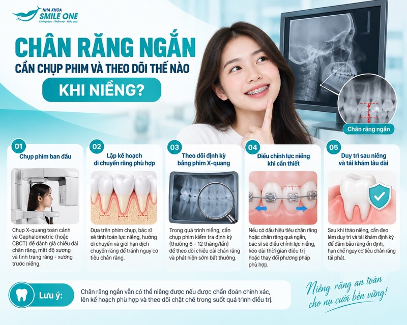 Chân răng đã có dấu hiệu tiêu tiến triển trước khi niềng.
