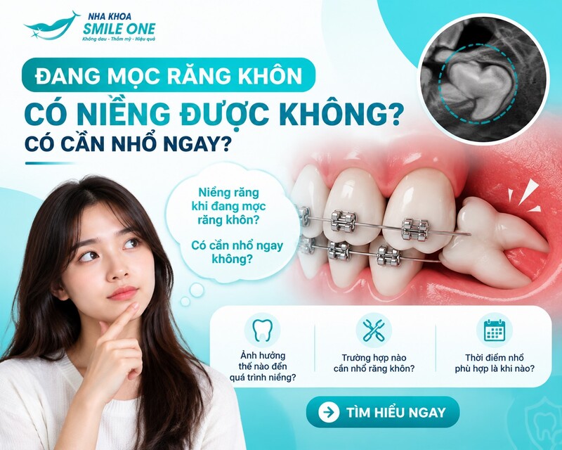 Đang mọc răng khôn vẫn có thể niềng, tùy vị trí, hướng mọc và tình trạng viêm.