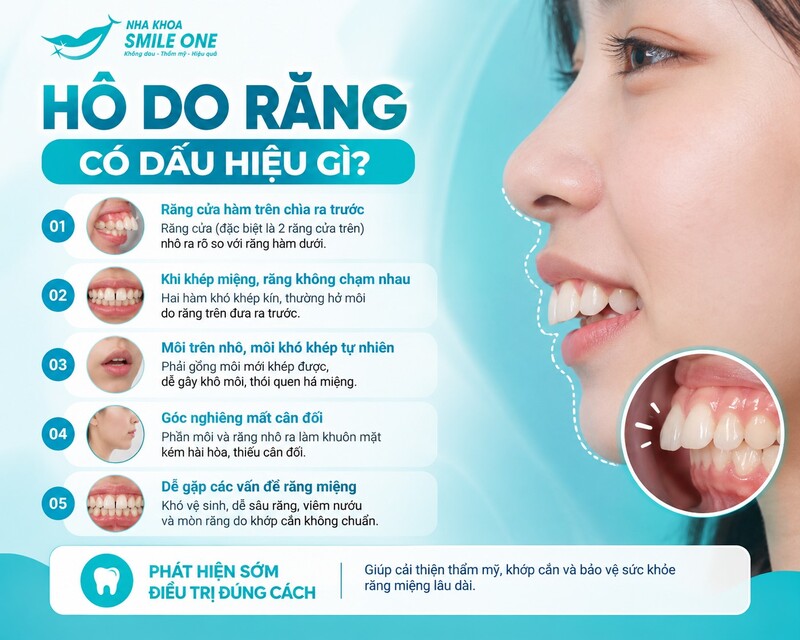 Hô do răng thì niềng, hô do hàm có phải phẫu thuật không?