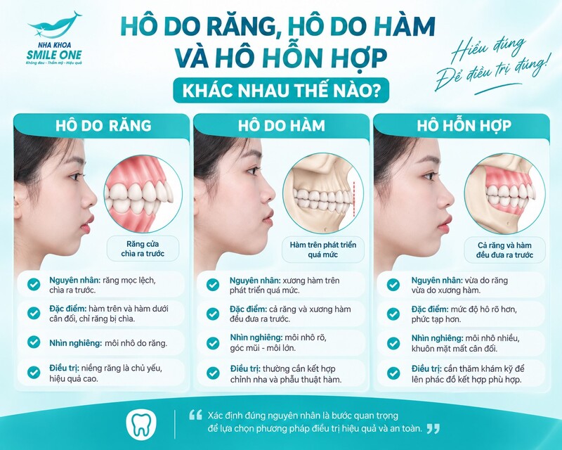 Làm sao phân biệt hô do răng và hô do hàm?