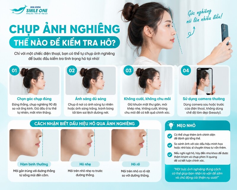 Chụp ảnh nghiêng thế nào để kiểm tra hô?