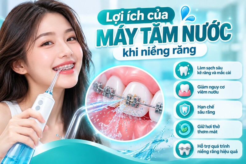Khi đeo mắc cài, việc vệ sinh khó hơn nhiều lần bình thường;