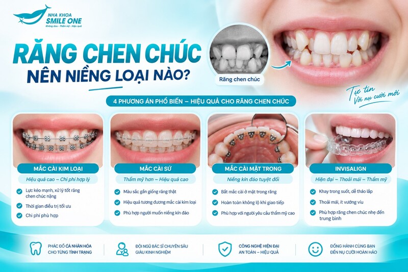 Răng chen chúc có thể niềng hiệu quả bằng mắc cài kim loại, tự buộc,