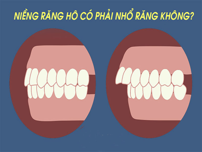 Nhìn vào bảng trên, sự khác biệt lớn nhất nằm ở mục tiêu điều trị: