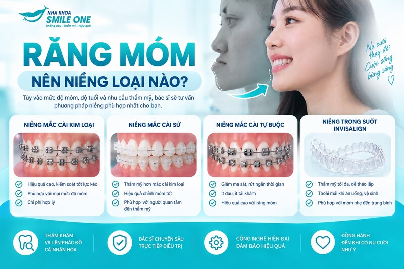 Răng móm do răng có thể niềng hiệu quả bằng mắc cài kim loại,