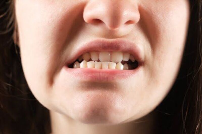 Với Nam, việc nhìn thấy một số răng mọc lệch chưa đủ để xác định