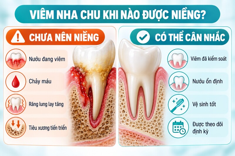 Không nên tạo lực chỉnh nha khi viêm nha chu còn hoạt động; bệnh cần được điều trị và kiểm soát ổn định trước.