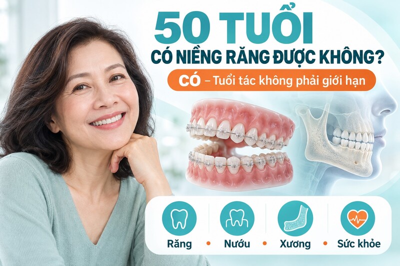 Người trên 50 tuổi vẫn có thể niềng răng; khả năng điều trị phụ thuộc vào răng, nướu, xương ổ răng và sức khỏe tổng thể.