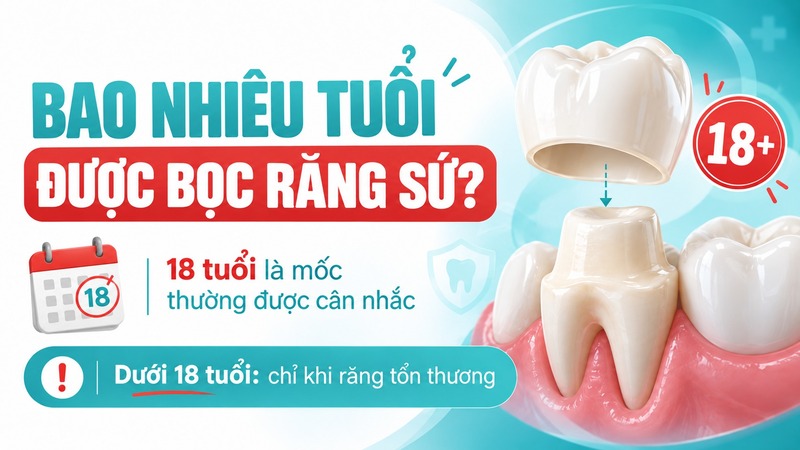 Độ tuổi phù hợp để bọc sứ phụ thuộc vào sự phát triển răng và chỉ định điều trị