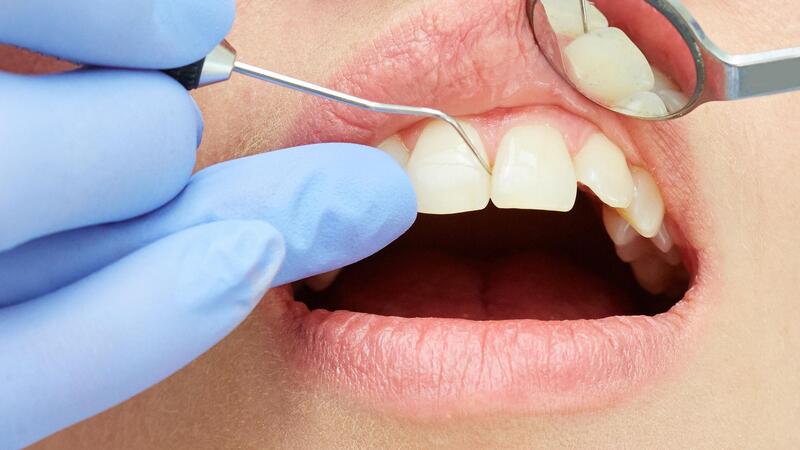 Kiểm tra răng, nướu và khớp cắn trước khi quyết định thời điểm làm sứ