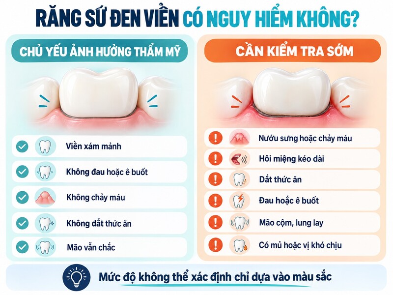 Dấu hiệu răng sứ đen viền cần kiểm tra sớm
