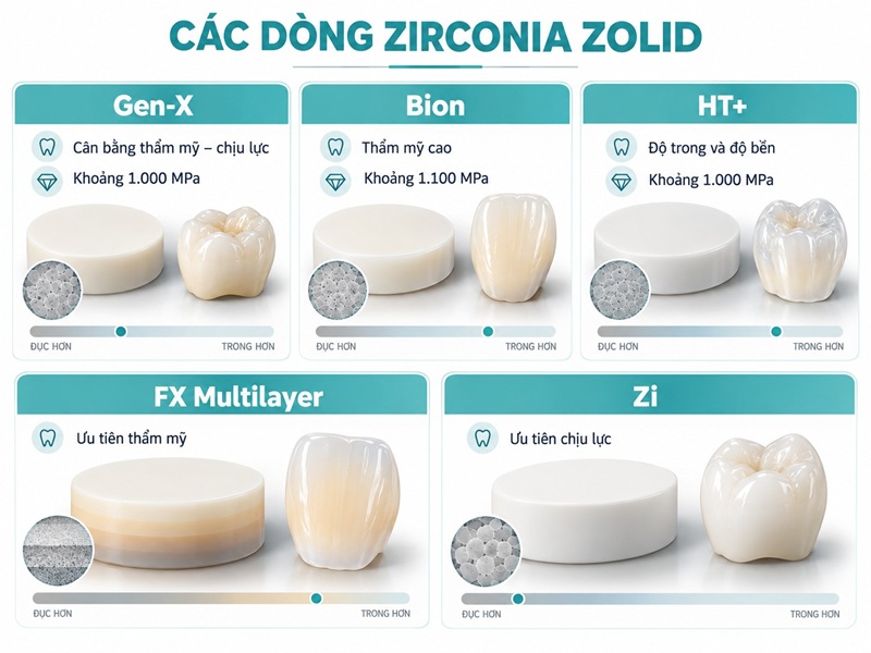Mỗi dòng Zolid được thiết kế cho một yêu cầu thẩm mỹ và chịu lực khác nhau.