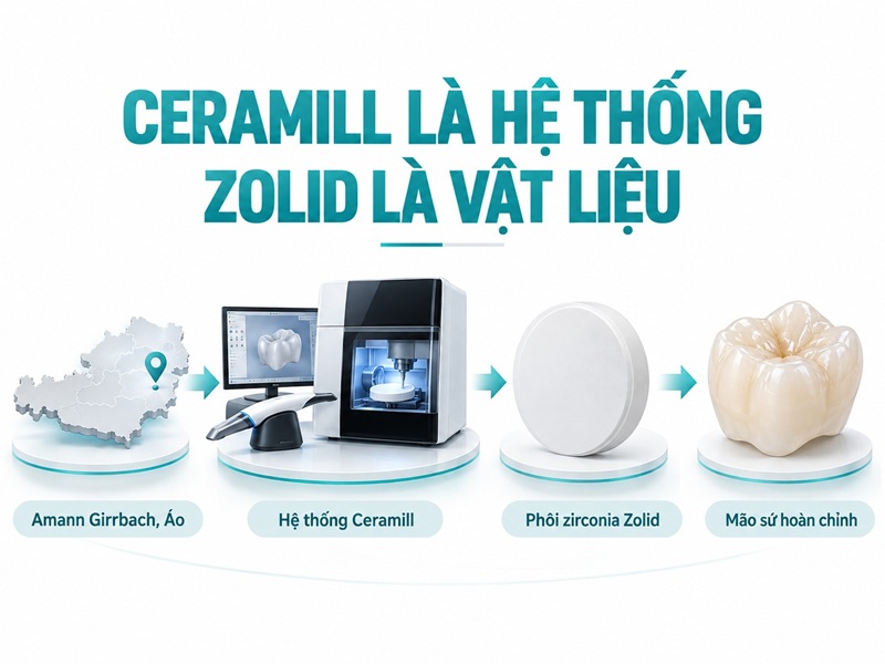 “Răng sứ Ceramill” thường là phục hình zirconia Zolid được chế tác trong quy trình CAD/CAM Ceramill.