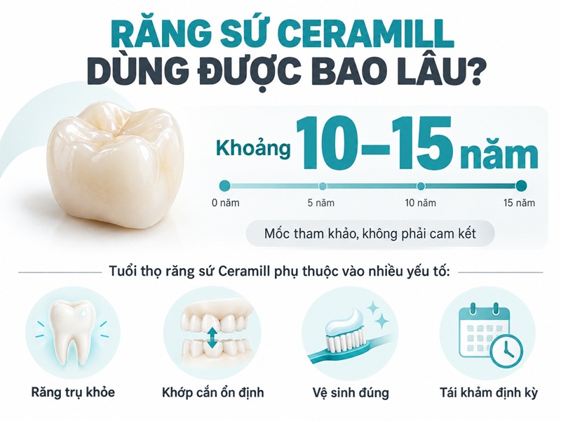 Vị trí răng quyết định yêu cầu về độ trong, độ bền và loại phôi Zolid.