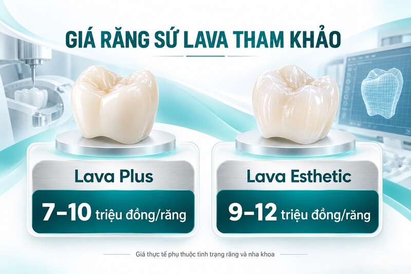 Giá Lava Plus 7–10 triệu và Lava Esthetic 9–12 triệu đồng một răng
