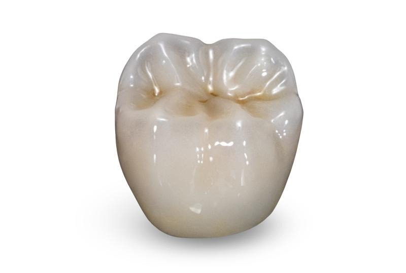 Hình minh họa mão răng toàn sứ Zirconia được sử dụng trong phục hình